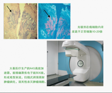 动力和特异性免疫治疗 我们的抗癌梦还有多远？