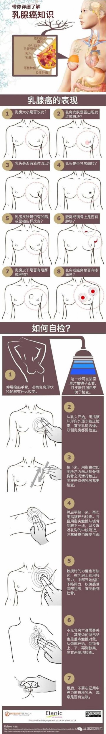 一图读懂：带您详细了解乳腺癌