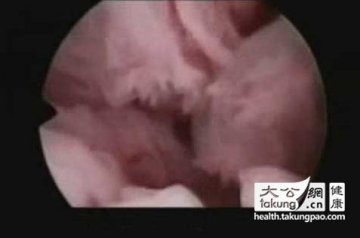 神奇的生命：实拍女性排卵真实过程