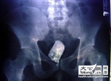 女人的私处可以放些啥