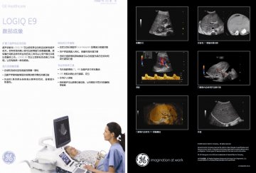 超声诊断仪 Diagnostic Ultrasound Scanner LOGIQ E9--官方高清创意广告(沪医械广审