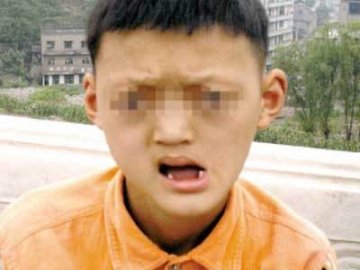 全球最恐怖的67种怪病