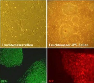 德国科学家重组人类羊水细胞获得诱导多能干细胞