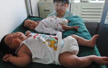 孕妇猛补营养品产下10斤多重的病婴