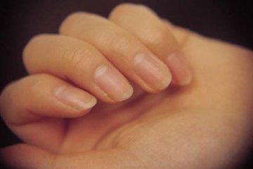 险丢命！指甲盖里小黑痣竟是大恶瘤 教你四招来识别