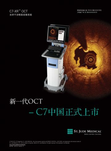 光学干涉断层成像系统-Optical Coherent Tomography Imaging System(国食药监械(进)字2012第3220078号)精美广告图欣赏