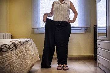 蜕变：西班牙女子手术减肥