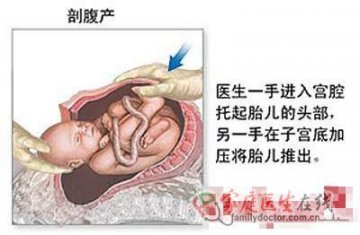 医学图解：剖腹产手术全过程