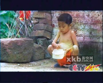 女孩患严重地中海贫血症 7年吃掉8万个烟头