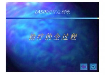 lasik8