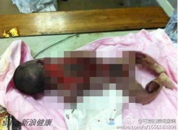 网曝福建泉州疑被医院保温箱烫死婴儿事件