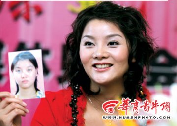 西安第一人造美女出炉 经26次手术耗资50万