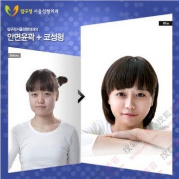 31个惊人韩国整容案例