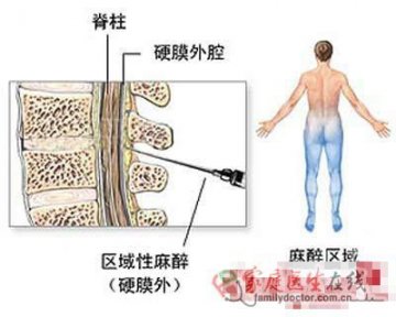 医学图解：剖腹产手术全过程