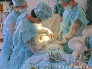 女性很伟大！惊心动魄剖腹产全程
