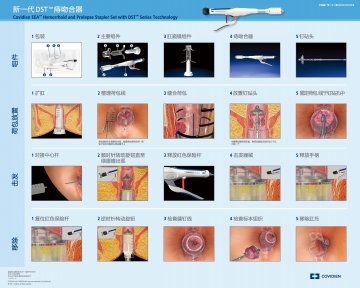 痔吻合器及附件-官方高清创意广告(沪医械广审(文)第2012010030号)