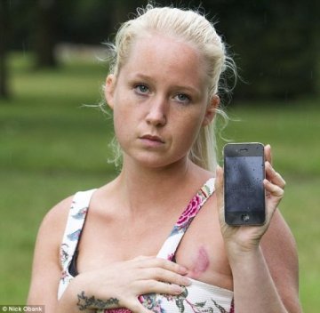 英国女子抱iPhone入睡 乳房被灼伤