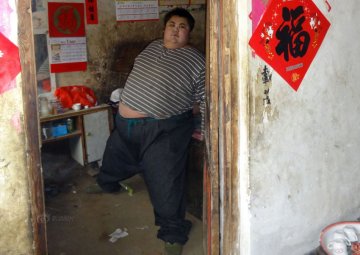600斤重“中国首胖”抢救无效死亡