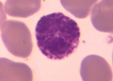 嗜碱性粒细胞（basophil）