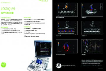 超声诊断仪 Diagnostic Ultrasound Scanner LOGIC E9--官方高清创意广告(沪医械广审