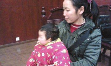 两家医院超声检查未发现胎儿畸形 产妇索赔20万