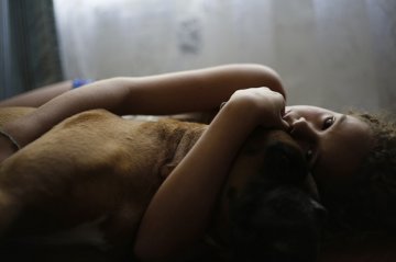 与脊柱矫正器相伴的少女青春时光