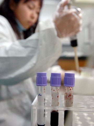 实拍：DNA亲子鉴定全过程