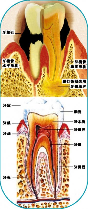 准妈妈须防牙周病