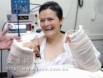 全球第一例女性双手同时移植手术成功