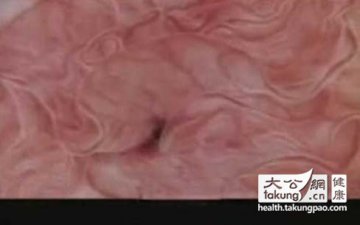神奇的生命：实拍女性排卵真实过程