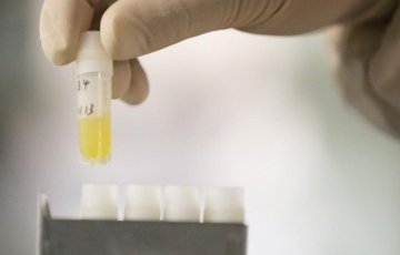 实拍精子志愿者捐献全过程