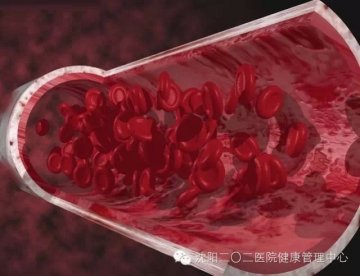 血管竟是这样堵住的！