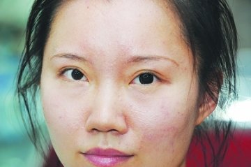 网购美瞳浸泡一夜碎成片 劣质美瞳充斥市场
