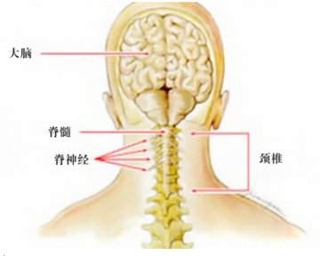 中经堂专家给你的颈椎病分型