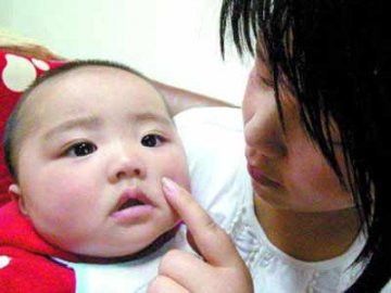 婴儿脸上长水泡 强生润肤露被疑致婴儿过敏