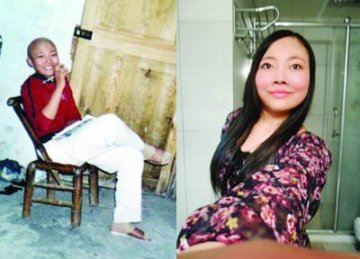 女子患红斑狼疮12年依然笑对人生 想写保健书