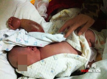 男婴大年初一降生遭捆绑“酷刑” 系风俗惹祸