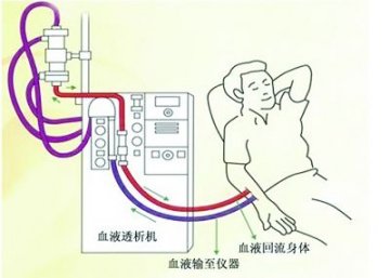 患者做血透遭遇断电 护士长和电工姗姗来迟
