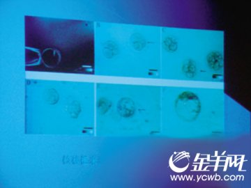 我国成功克隆5枚人类胚胎 将用于医疗领域
