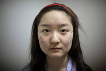 韩国摄影师记录5位模特血腥整容蜕变全程