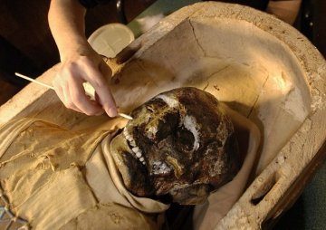美医院开棺清理修复埃及2500年木乃伊