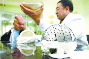 狮面人手术历经19个小时获得成功