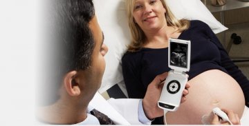 新一代便携式超声可视化诊断工具Vscan