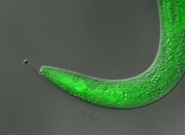科学家掌握线虫瘫痪开关或将医治瘫痪病人