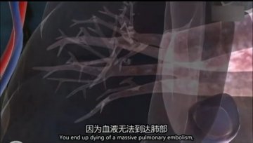 医学解读：男子腿绑香肠冒充阳物为何丧命