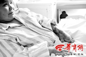 患者截肢后脚指头移植到手上成活
