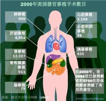 探秘人类器官移植全过程：移植后会出现排斥反应