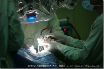 第306医院顾建文解读巨大天幕脑膜瘤切除术