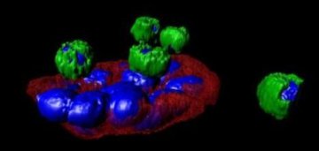 美科学家为癌细胞染色 可迅速确定扩散方式路径