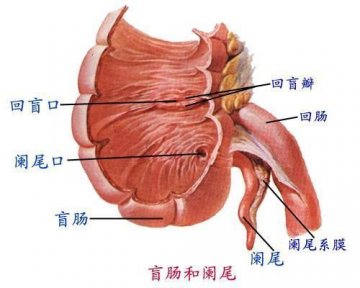 阑尾没用还老发炎